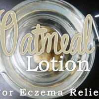 All Natural Eczema Lotion
